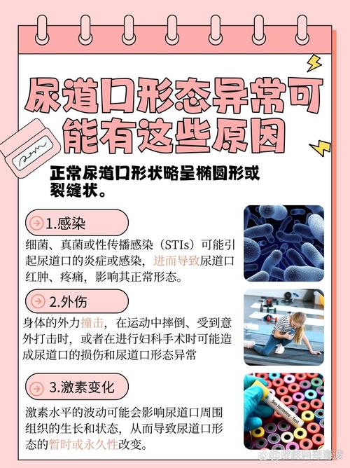 丰满老女人免费在线的相关介绍